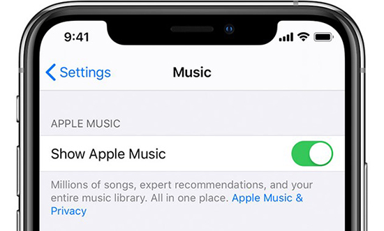 turn on show apple music to solve apple music issues
